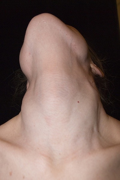 גרון